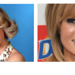 Amanda Holden Plastic Surgery Before and After