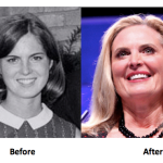 Ann Romney Plastic Surgery Before And After