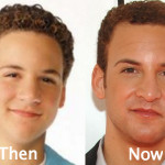 Ben Savage Plastic Surgery Before And After