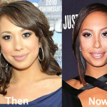 Cheryl Burke Plastic Surgery Before and After