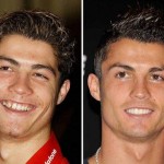 Cristiano Ronaldo Plastic Surgery Before And After