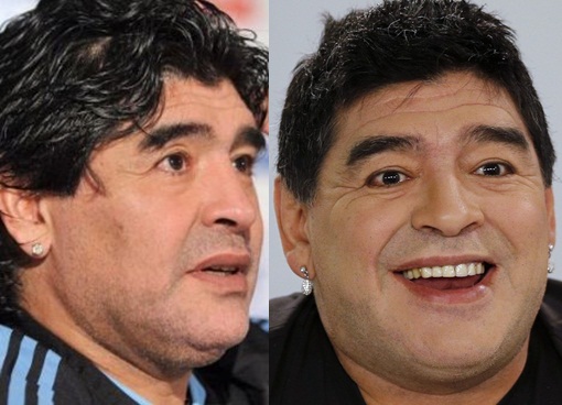 Diego-Maradona-Plastic-Surgery-Before-and-After