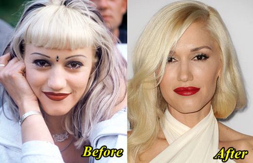 Gwen-Stefani-Plastic-Surgery-Before-and-After