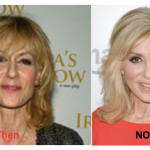 Judith Light Plastic Surgery Before and After
