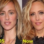 Kim Raver Plastic Surgery Before and After