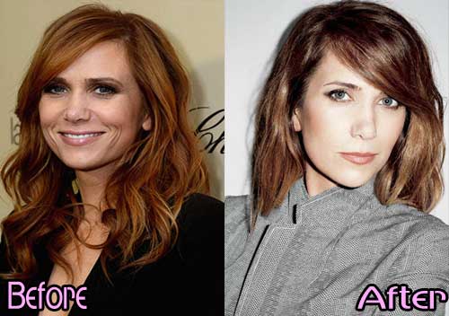 Kristen-Wiig-Nose-Job-Before-and-After-Photos
