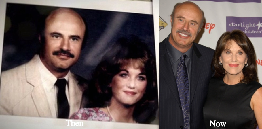 robin-mcgraw-and-dr-phil-before-and-after