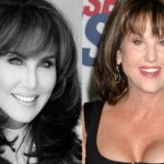 Robin McGraw Plastic Surgery Before And After