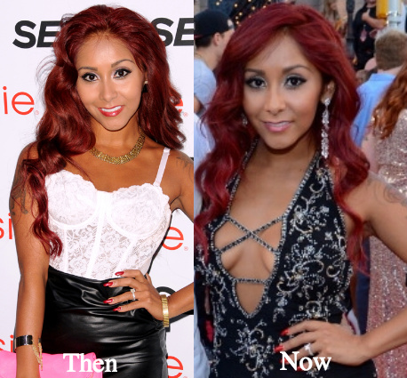 Snooki boob job before and after