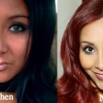 Snooki Plastic Surgery Before and After Photos