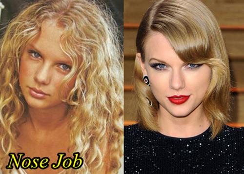 Taylor Swift nose job