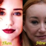 Tori Amos Plastic Surgery Before And After