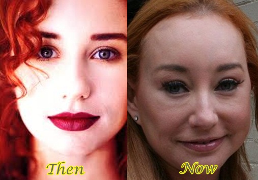 Tori-Amos-Plastic-Surgery-Before-After-Photos
