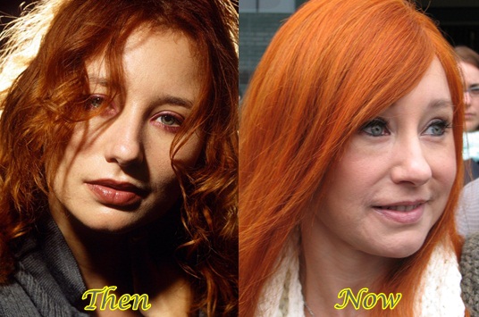 Tori-Amos-Plastic-Surgery-Before-After-Photosd