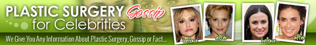 Latest Plastic Surgery Gossip And News. Plastic Surgery Tips and Advice