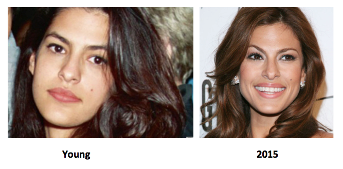 eva mendes plastic surgery before and after