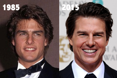 Did Tom Cruise Undergo Plastic Surgery?