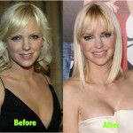 Anna Faris Plastic Surgery Before and After Photos