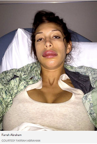 Farrah Abraham Lips bloated after plastic surgery