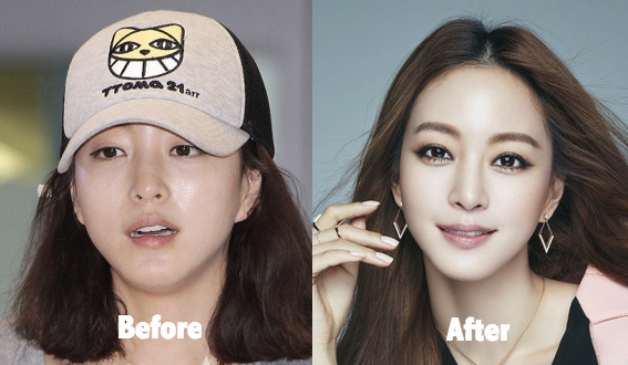 Han Ye Seul Plastic Surgery