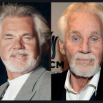 Kenny Rogers Plastic Surgery – Before and After Photos