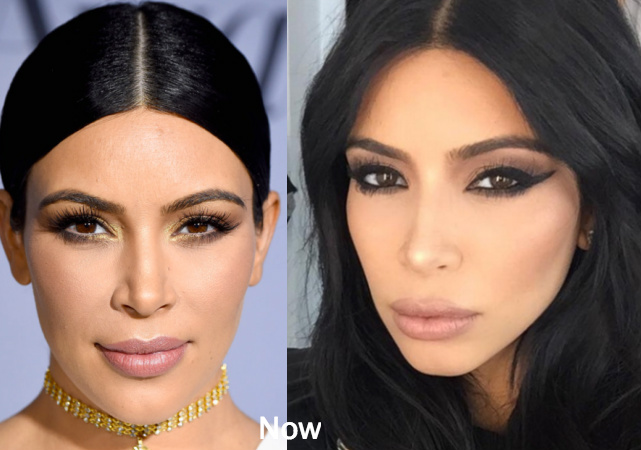 Kim Kardashian Before plastic surgery