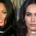 Megan Fox Plastic Surgery Before And After Photos