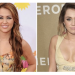 Miley Cyrus Plastic Surgery Before and After Pictures