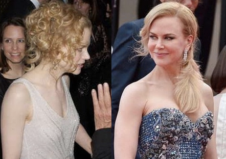 Nicole Kidman plastic surgery breasts