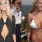 Tara Reid Plastic Surgery Before and After Photos