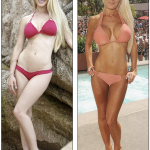 Heidi Montag Plastic Surgery – Before And After Photos
