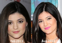 Kylie Jenner Plastic Surgery Before and After Eyebrows