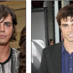 Reid Ewing Plastic Surgery Before and After Regrets