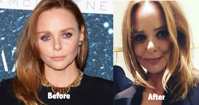 Stella McCartney Plastic Surgery Rumors are getting around due to her appearance on instagram 2015