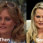 Beverly D’Angelo Plastic Surgery Before and After Photos