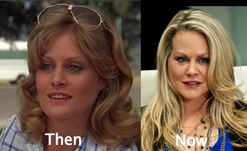 Beverly D Angelo plastic surgery before and after photo
