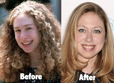 Chelsea Clinton look better as she age