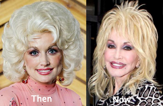 Dolly Parton Cosmetic Surgery rumours