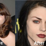 Frances Bean Cobain Plastic Surgery Before and After Photos