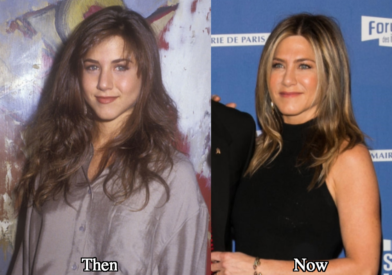 Jennifer Aniston Botox before and after photos
