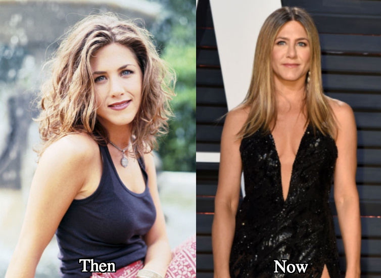 Jennifer Aniston boob job before and after photos