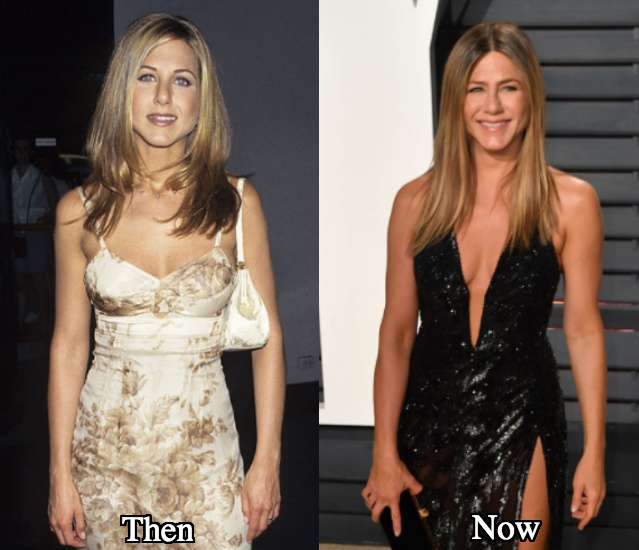 Jennifer Aniston breast surgery before and after