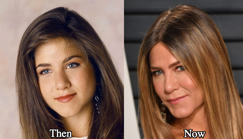 Jennifer Aniston nose job before and after photos