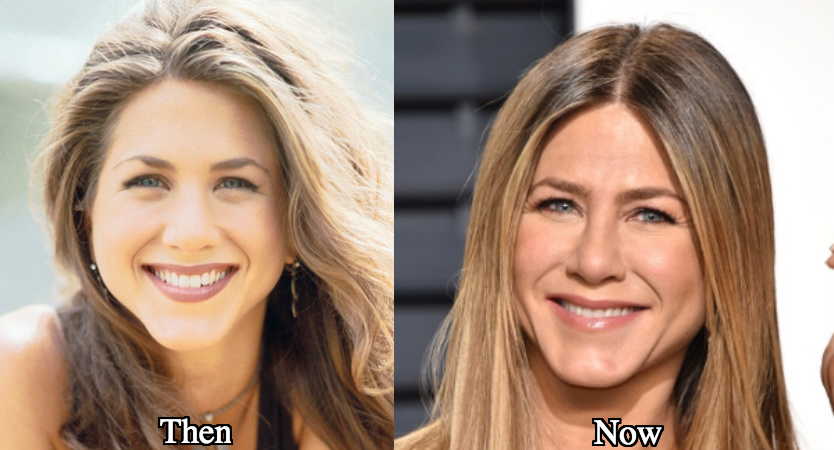 Jennifer Aniston nose job now and then pictures