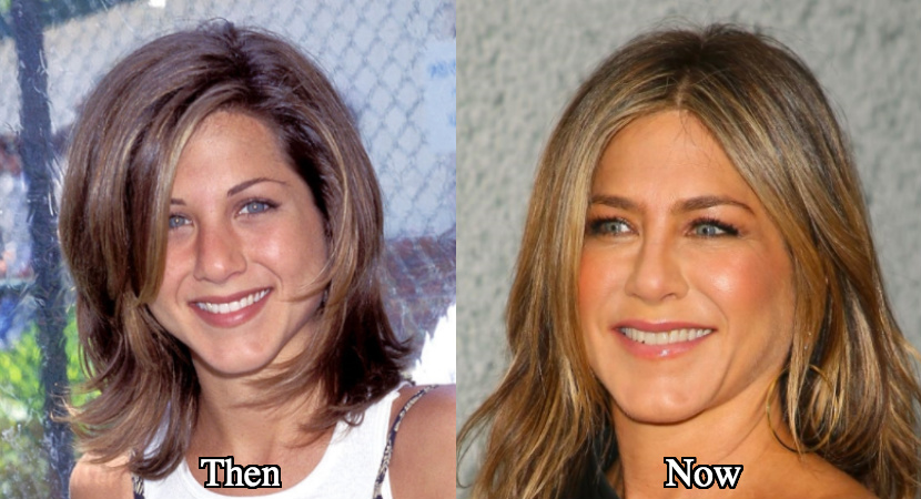 Jennifer Aniston nose job speculations and rumors