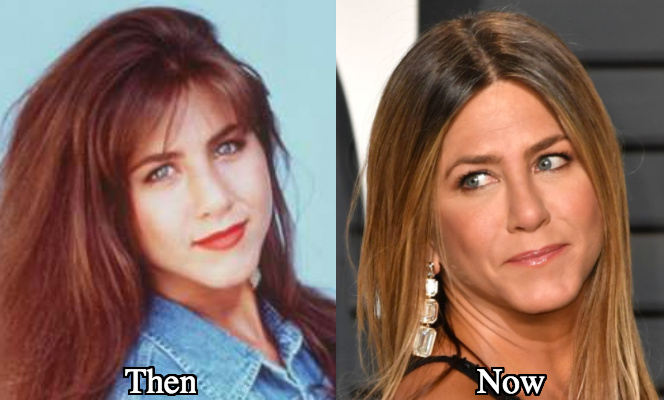 Jennifer Aniston plastic surgery now and then photos