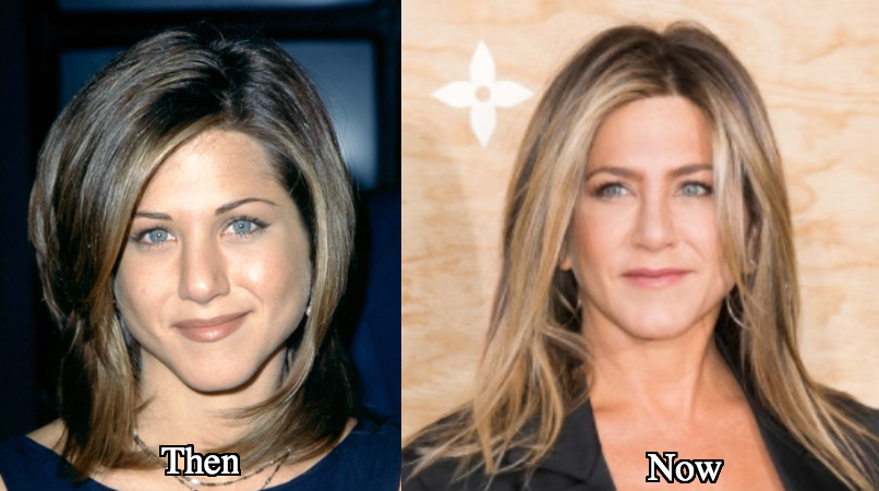 Jennifer Aniston sharp chin surgery before and after