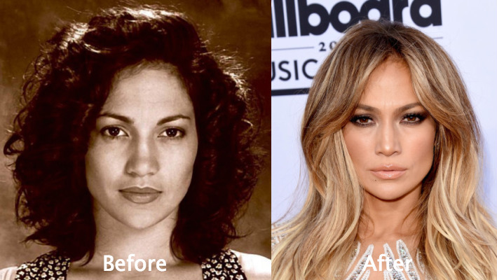 Jennifer Lopez cosmetic surgery rumors put to the test