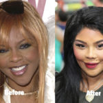 Lil Kim Plastic Surgery Before and After Photos