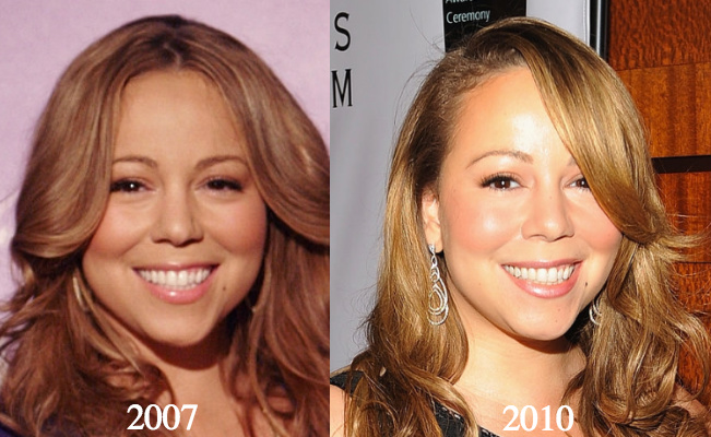 Mariah Carey Plastic Surgery 2007 2010